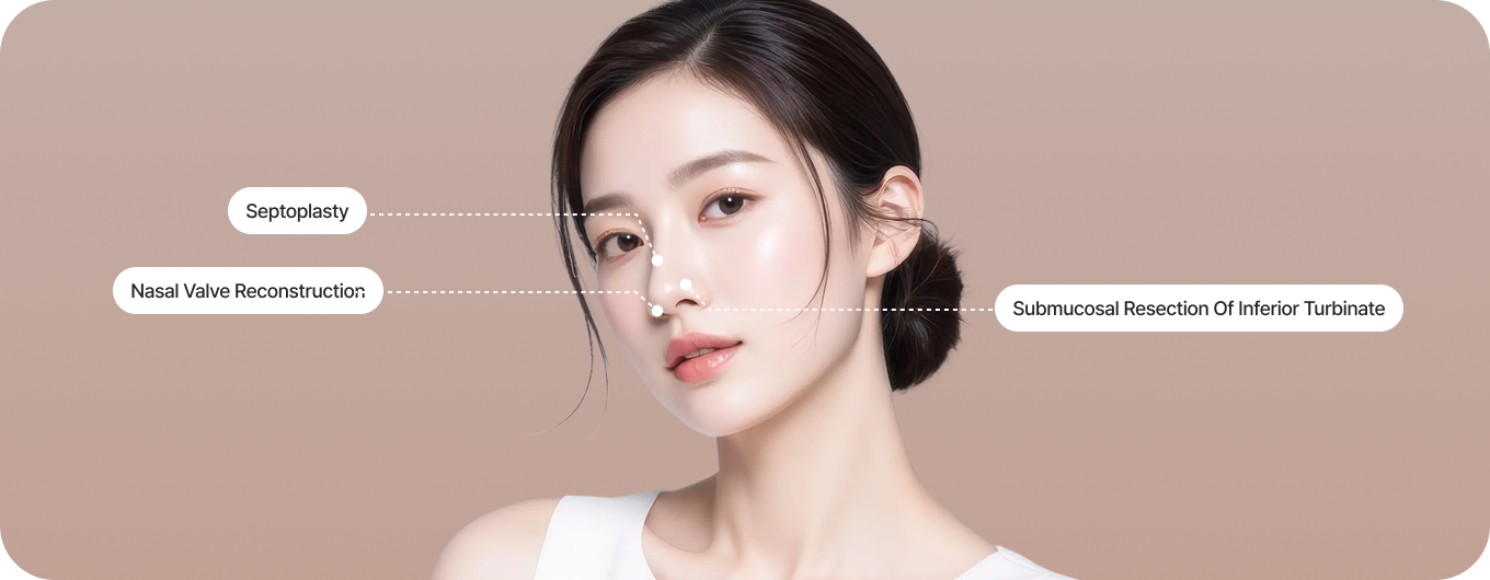 Functional Rhinoplasty