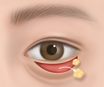 매끄러운 눈가 완성