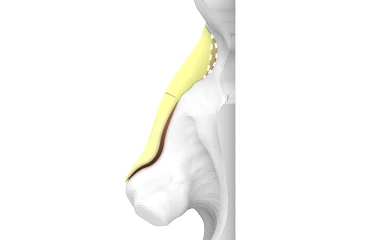맞춤형 쏘핏 관련 사진